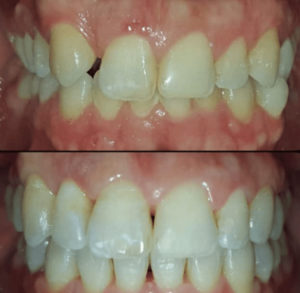 Odontología Preventiva y Ortodoncia / Dental Carmina Parra