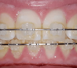 Odontología Preventiva y Ortodoncia / Dental Carmina Parra