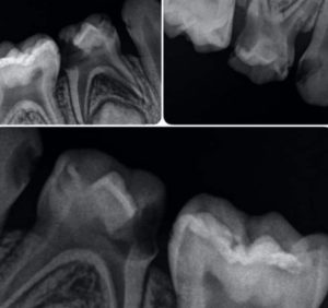 Odontopediatría / Dental Carmina Parra