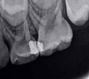 Odontopediatría / Dental Carmina Parra