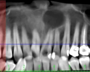 Cirugía Maxilofacial / Dental Carmina Parra