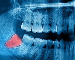 DENTAL CARMINA PARRA