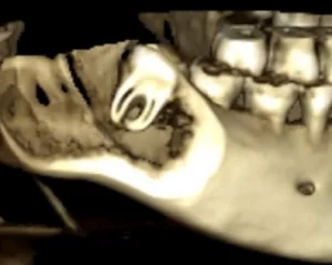 DENTAL CARMINA PARRA